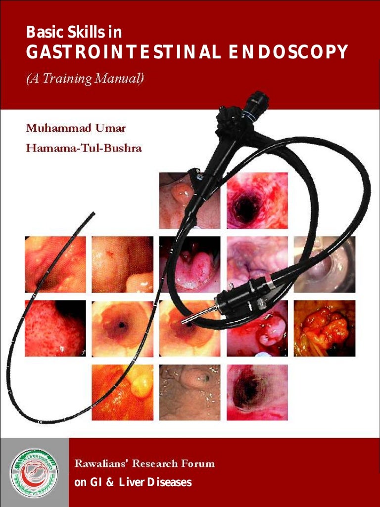 Endoscopic examinations: methods, patient preparation, features of the procedure 85 Endoscopic examinations: methods, patient preparation, features of the procedure 38